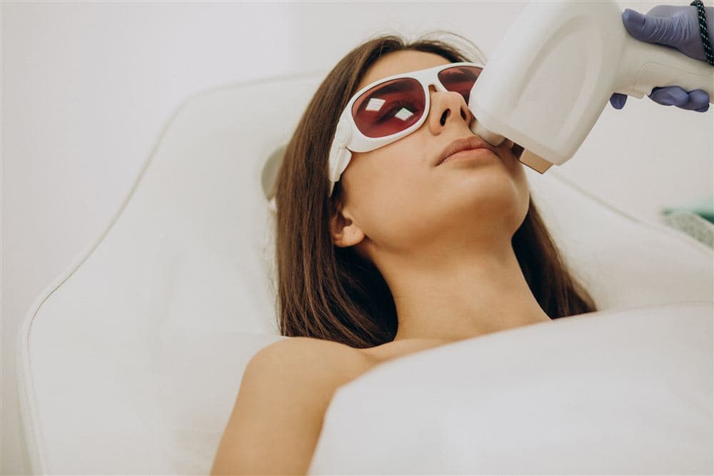 Full face laser hair reduction treatment