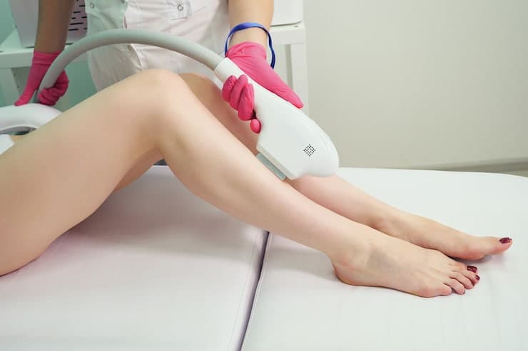 Full legs laser hair reduction treatment